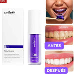 V34 PARA SONRISAS MAS BLANCAS