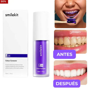 V34 PARA SONRISAS MAS BLANCAS